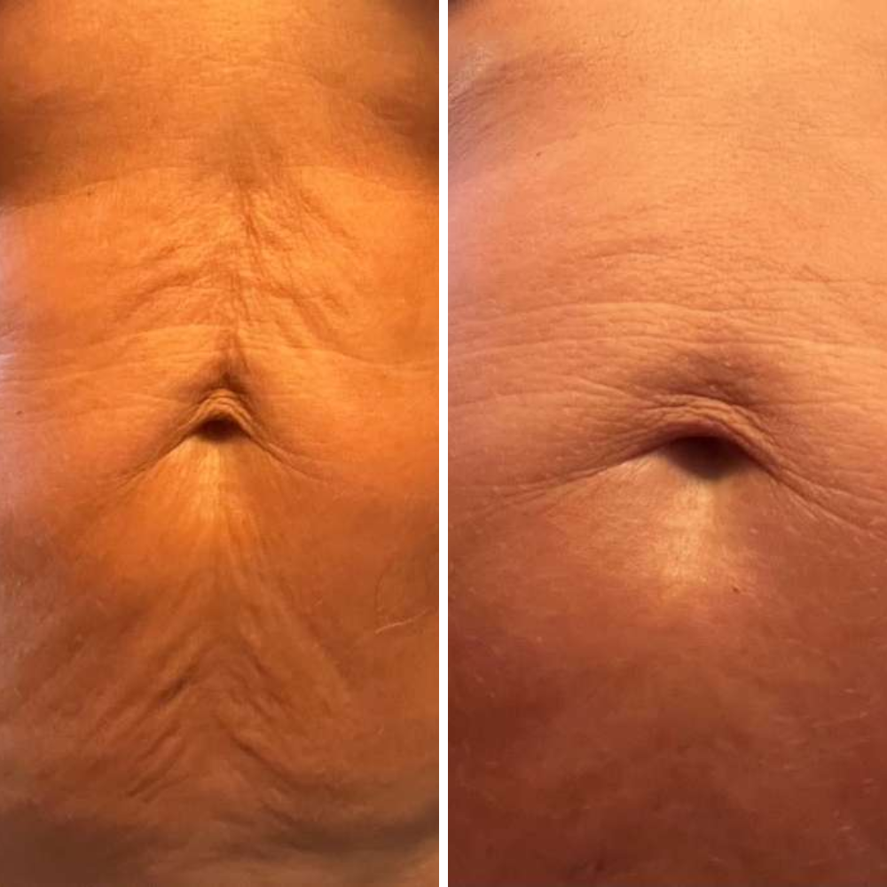 Svea Magic Body Oil